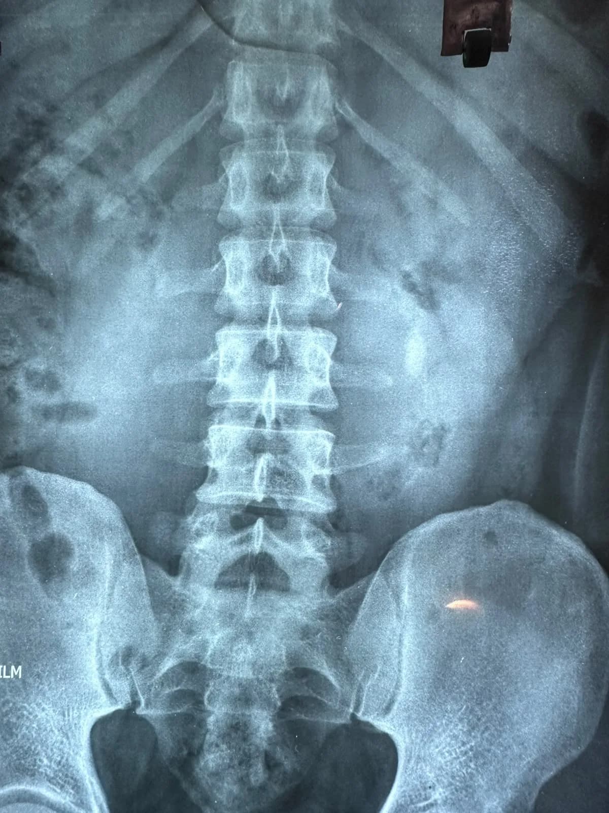 08 Imaging Plain Abdominal Xray Kub